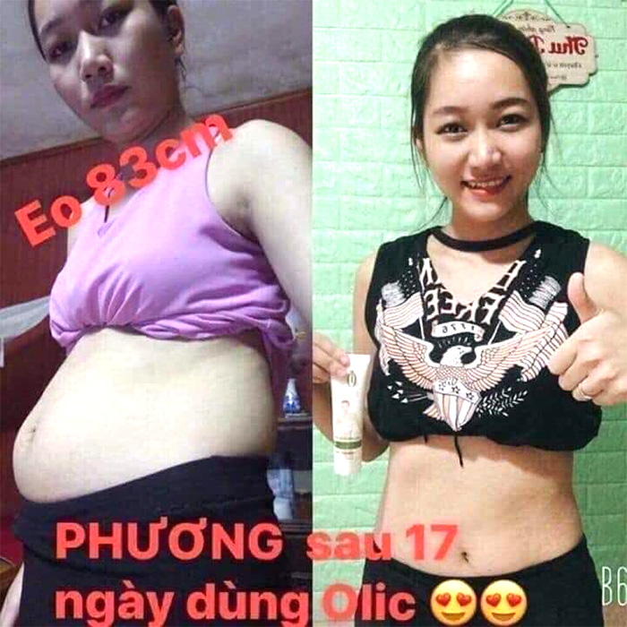 kem tan mo olic anh 0002